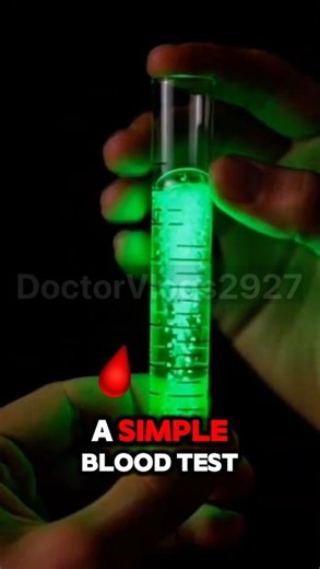 Liver Function test 😓| #lft #blood #test | #foryou #fyp | #trending |