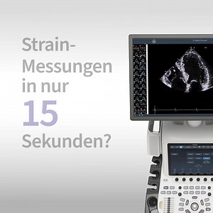 Kardiovaskuläre Diagnostik mit Vivid™ Ultraschallsystemen – einfach effizienter mit KI-Support und Automatisierungstools. | GE HealthCare