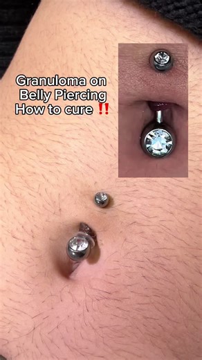 Granulomas can take time to heal, but with the right jewelry, proper care, and less irritation, healing is absolutely possible 💫 After are by @Base Laboratories #fyp #viralvideo #healingjourney #piercing #belly