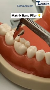 189K views · 3K reactions | Matrix Band Plier 磊 Credit : @tashmed_torvm #dentistry #dentist #dentalphotography | Dental Art | Facebook