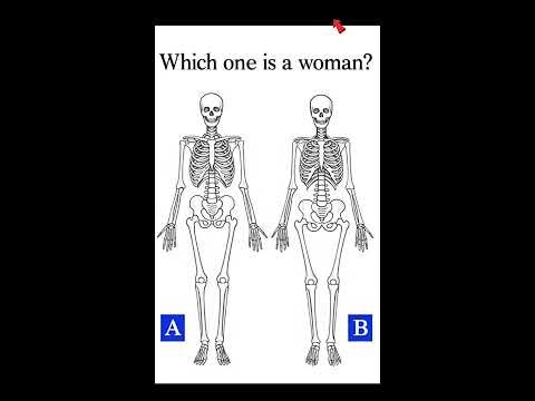 Which One Is a Woman 🤔 Skeleton IQ TestChallenge.
