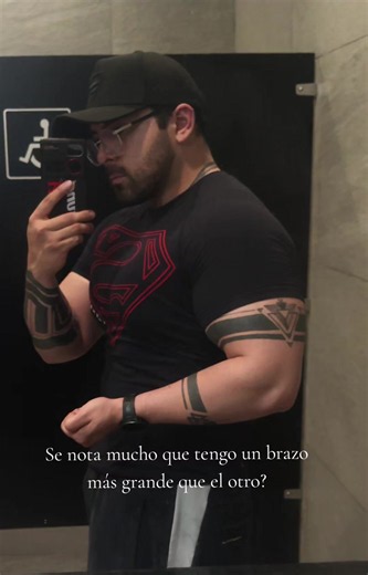 ¿Se nota que tengo un brazo más grande que el otro? cómo disimular y entrenar la asimetría