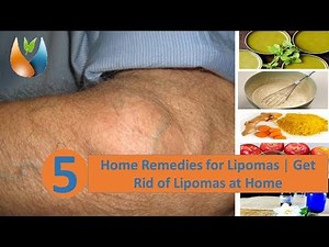 5 Home Remedies for Lipomas | Get Rid of Lipomas at Home