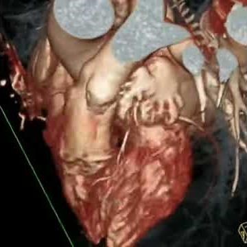 Live view of the human heart beating