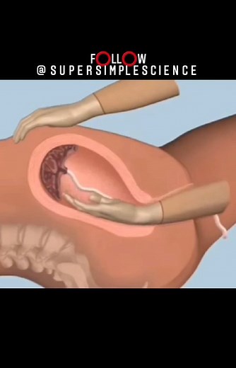 Super Simple Science | How to perform Manual Removal of the Placenta‼️ 〰️〰️〰️〰️〰️〰️〰️〰️〰️〰️〰️〰️〰️〰️〰️〰️〰️〰️〰️ Haven’t followed @SuperSimpleScience Yet 😅. You are... | Instagram