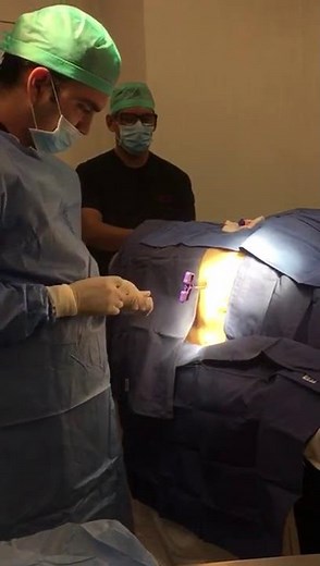Aspirado de médula ósea y biopsia de hueso.