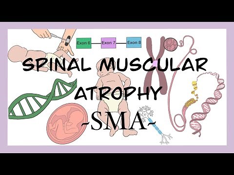 Decoding Spinal Muscular Atrophy (SMA): A Comprehensive Insight