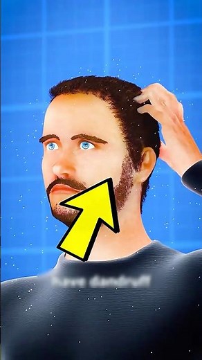 Why Your Scalp Itches Like Crazy (And It’s Not Always Dandruff!)!? 😁