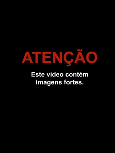 Na terça-feira, 3 de março, um trabalhador ficou gravemente ferido após o cesto aéreo em que estava pegar fogo e ele cair dele. O acidente aconteceu em Baton Rouge, na Louisiana (EUA). Os bombeiros responderam à ocorrência e levaram a vítima ao hospital em estado grave. O caso está em investigação, mas a suspeita é de que teria uma falha mecânica que iniciou o incêndio. Imagens: reprodução #EUA #Louisiana
