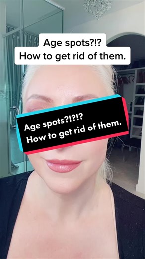 Best Ways to Remove Age Spots: Expert Tips and Treatment