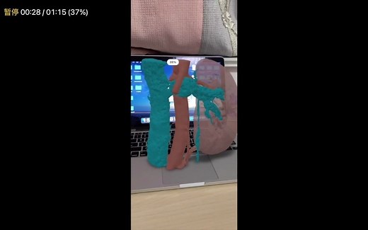 1小时学会CT三维可视化--3D Slicer视频教程 增强现实AR（七）