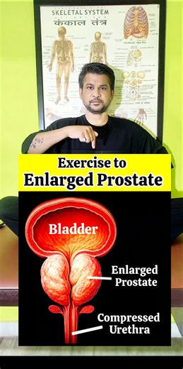 Exercise to Cure Enlarged Prostate #exercise #wellness #selfcare