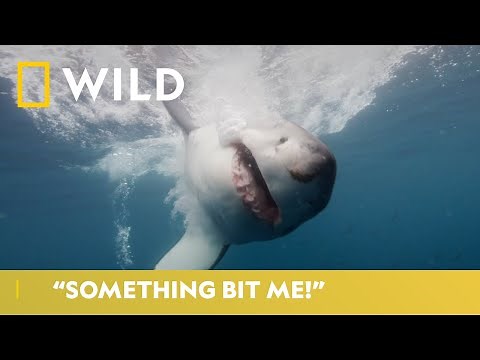 Bites That Sent People To The E.R. | Something Bit Me | National Geographic Wild UK