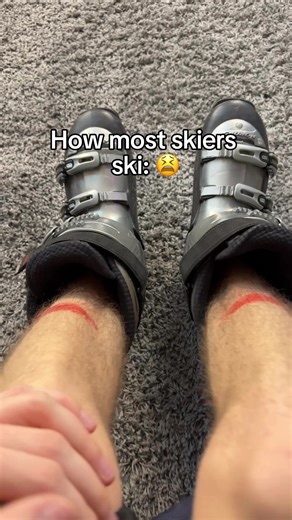 These shin blockers saved my shins 😳😍 #skitok #wintersport #skiing #wintergear