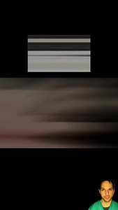 12 reactions · 28 comments | Did you know we still use leeches for...