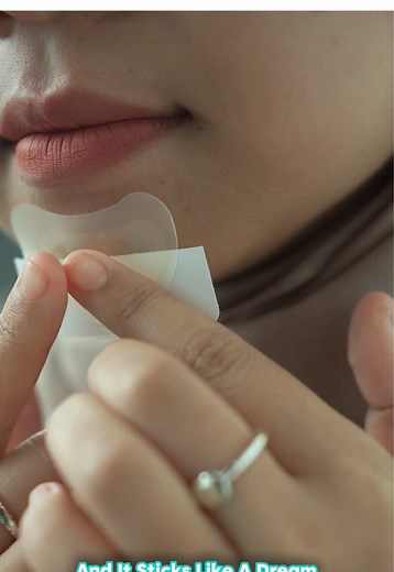 New Derma Angel XL Patch: Effective Acne Solution