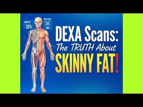 DEXA Scans: The Truth About “Skinny Fat”