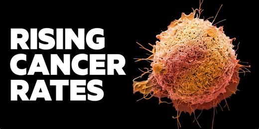 Why more young people are getting cancer