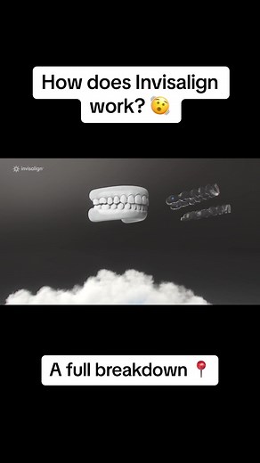 How does Invisalign work? 🫨 Get a full breakdown of how the Invisalign treatment works through this Invisalign journey map. 🦷 Invisalign is a clear orthodontic aligner used to correct the alignment of teeth and jaws. The process starts with a dental consultation to determine if Invisalign is suitable for you. If approved, a 3D scan of your teeth is used to create a treatment plan and a series of custom aligners. These aligners, changed every one to two weeks, are worn 20-22 hours per day, grad