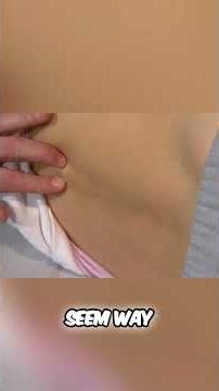 Count Vertebrae Easy Methods for L1 T10 Levels #science