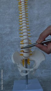 Artificial herniated disc and medical care structure and model of spine. Treatment of herniated discs and spinal diseases