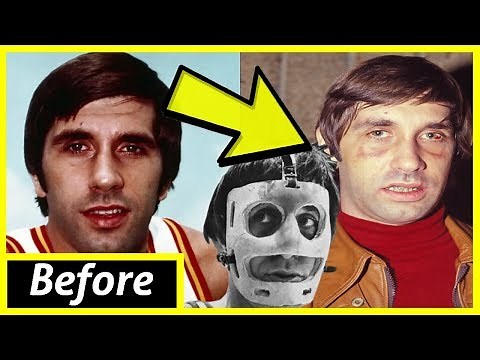 This Deadly Punch Killed Two NBA Players Lives