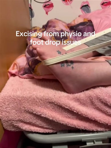 Understanding Foot Drop and Its Physical Therapy Solutions