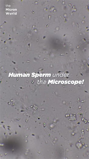 Human Sperm Under the Microscope (1000x) | Microscopic Life in Motion