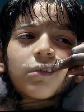 The boy turns into a werewolf at night！#movie#movieclips