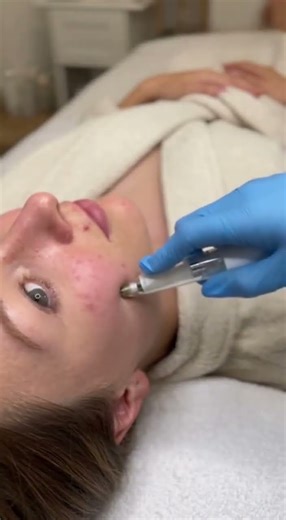 American Girl Cheek + Chin Vacuum Doctor ASMR ✨