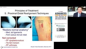 Patellofemoral Subluxation and Dislocation in the Adult