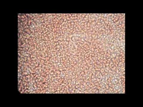 Heartworm Video 2012 - Morgan Animal Hospital