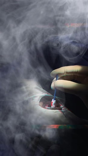 Ophthalmology Services by Dr. Arsala Zaman Mohmand