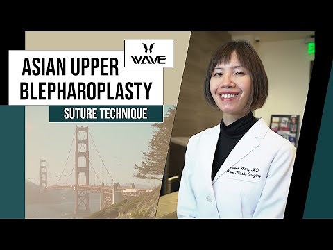 Dr. Wong discusses the Suture Technique for Upper Blepharoplasty | Wave Plastic Surgery