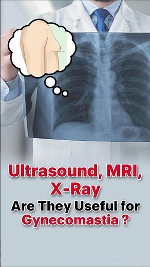 Ultrasound, MRI, X-Ray for Gynecomastia – Worth It?