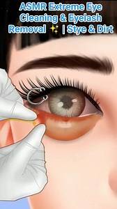 124K views · 398 reactions | ASMR Extreme Eye Cleaning & Eyelash Removal ✨ | Stye & Dirt #reels #video #3danimation #trending #cleaning #shorts #asmr #satisfying | Akhilesh Yadav | Facebook