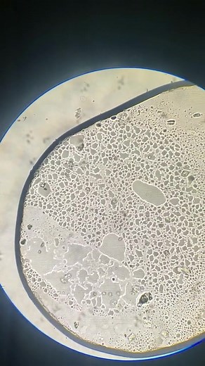 Découverte fascinante : l'eau du robinet vue au microscope ! 💧