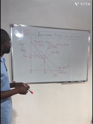 Understanding Monopoly and Abnormal Profits in Economics