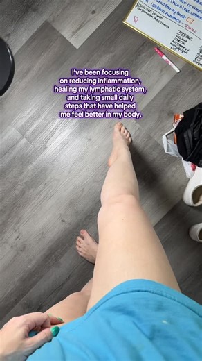 This is what stage 1 Lipedema looks like on me. 💛 In the beginning, it can be so subtle — swelling, heaviness, tenderness, or fat that doesn’t respond the same way to diet and exercise. For years, I didn’t understand what was happening to my body. I’ve learned that trauma, hormone imbalances, and inflammation can all make symptoms worse… but there are ways to manage it. By supporting my lymphatic system, focusing on anti-inflammatory nutrition, and balancing my hormone health, I’ve been able to