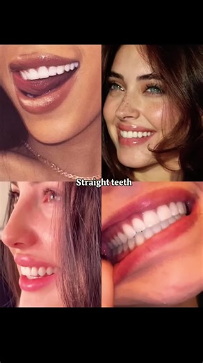 Discover Your Teeth Type Today