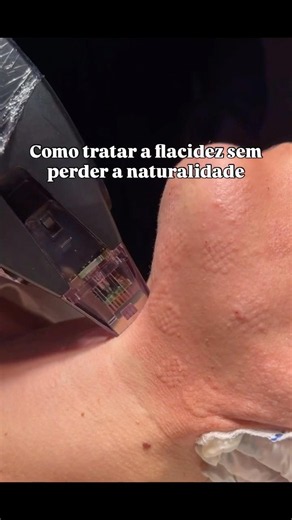Como o Morpheus Premium funciona