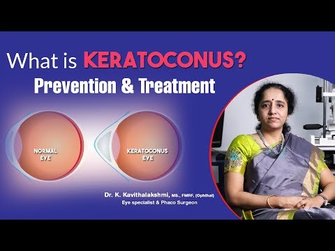 What is Keratoconus? | Prevention & Treatment for Keratoconus | Dr. Kavithalakshmi