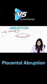 Placental Abruption Explained for FMGE | Concealed vs Revealed Hemorrhage| DocTutorials