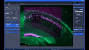 Overlay and organize your images from any source and keep the context. From acquiring an overview image, to defining ROI's, and even when changing between different imaging systems. Stay on top of things with ZEISS ZEN Connect - both during imaging and later when sharing the whole story of your experiment. Discover ZEN Connect and download your free trial version: https://zeiss.ly/zen-connect #zeiss #microscopy #imaging | ZEISS Microscopy