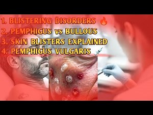 Blistering Disorders | Pemphigus Vulgaris & Bullous | Pemphigoid Explained