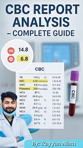 How to Read CBC blood test Report|| #labtechnician #CBCtest #bloodtest #bloodtestreport | Rayyan Alam