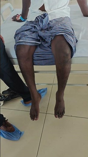 pendular knee jerk #neurology