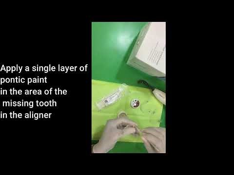 Pontic Paint Placement in Aligners