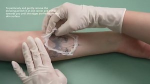 Dimora Transparent Film Wound Dressing 6x8 inch 20 Packs with Hypoallergenic Adhesive