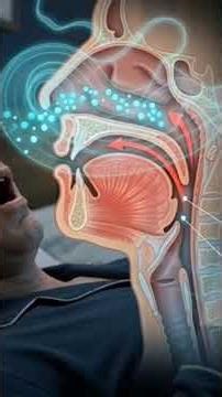 #sleep apnea#cpap machines#treatment for snoring